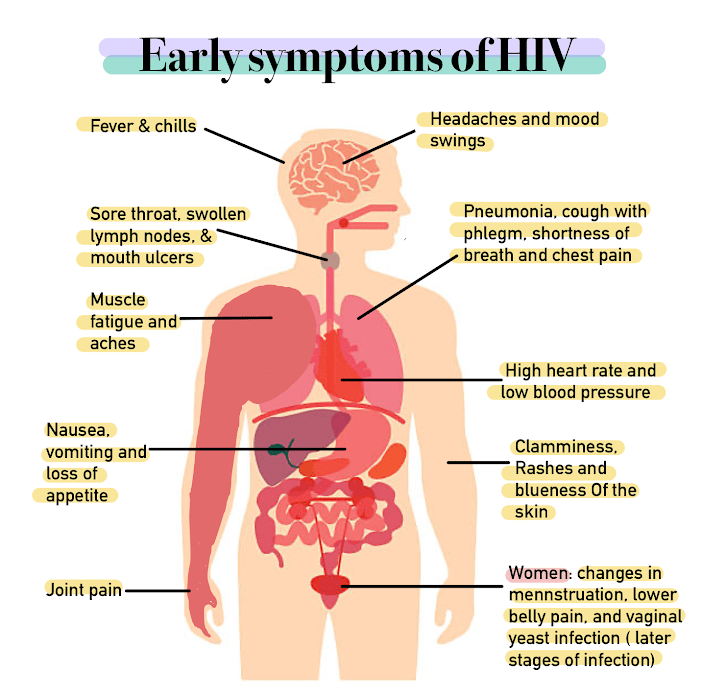 Do People with HIV have AIDS? 1