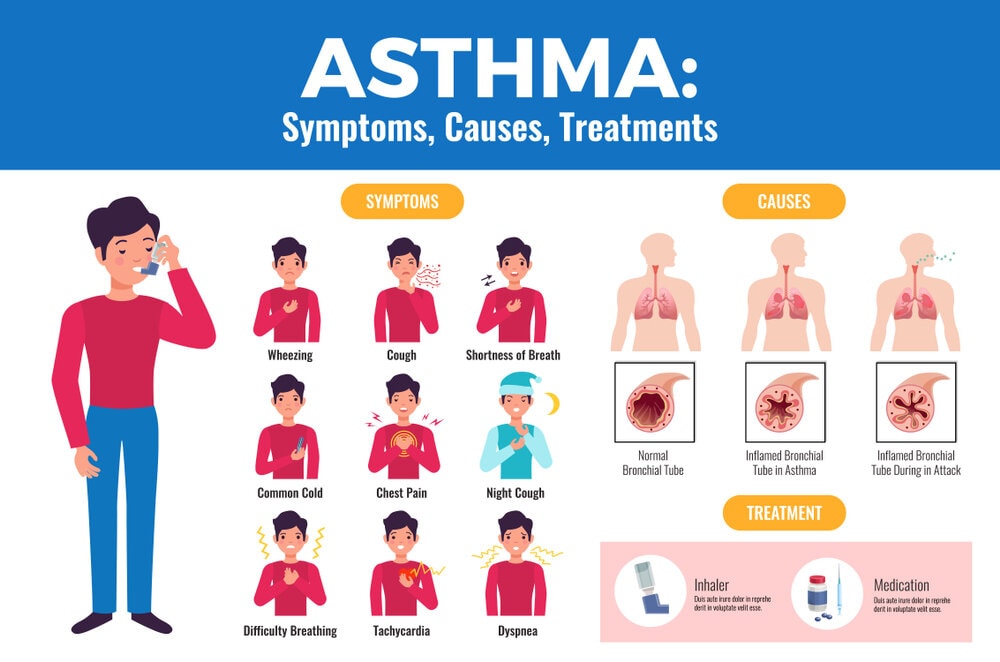 Asthma Asthma