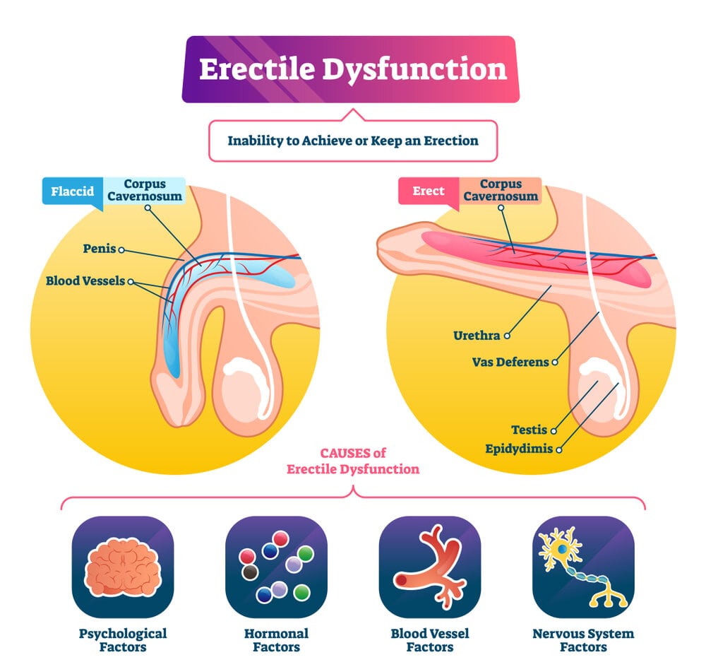 Erectile Dysfunction Causes Erectile Dysfunction Causes