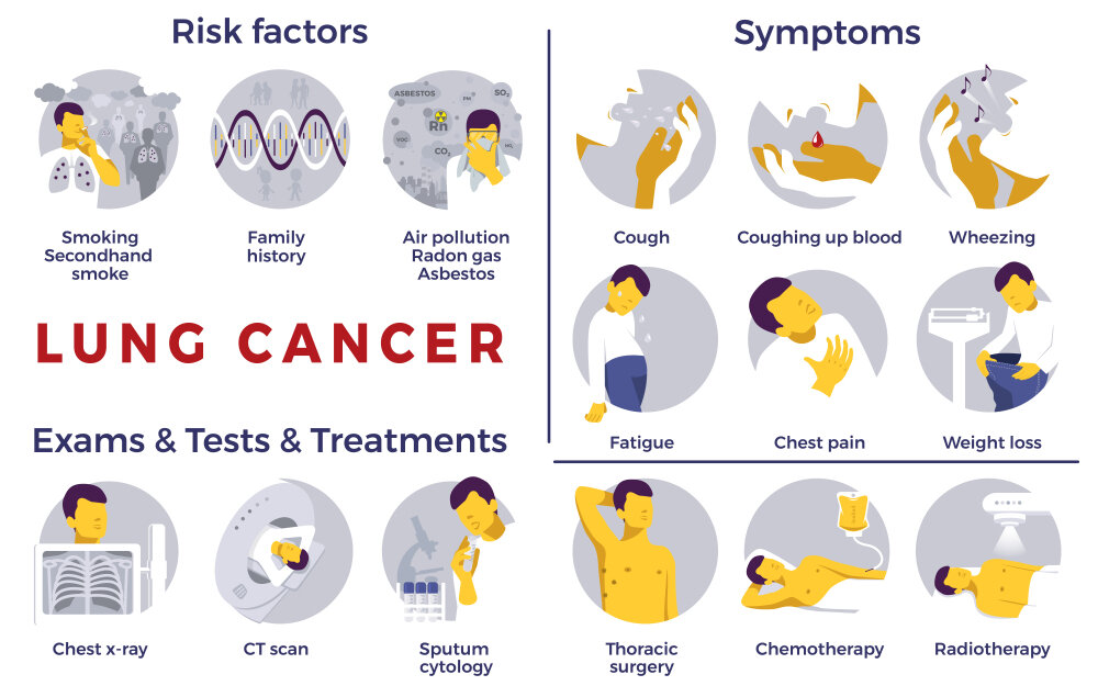 Lung Cancer: Symptoms, Risks, Treatment