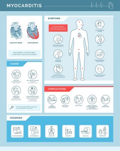 Myocarditis Causes and Symptoms 