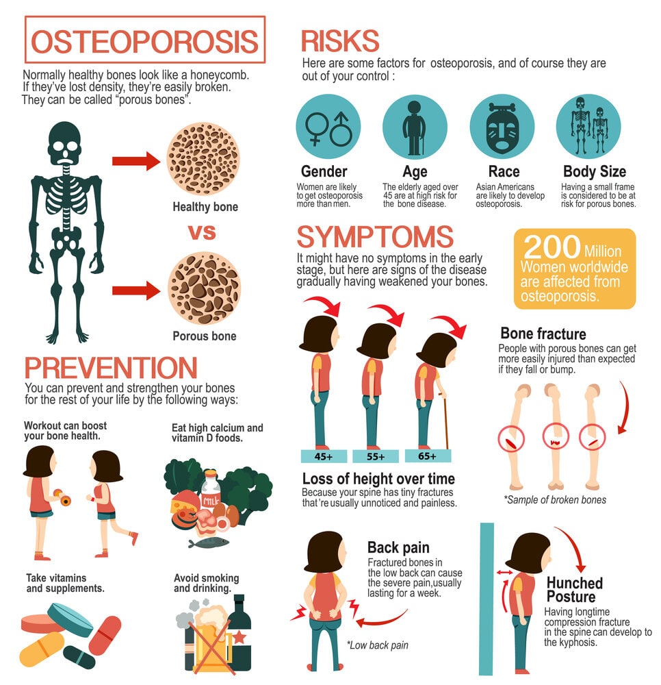 Osteoporosis: Risks, Prevention, and Symptoms