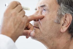 Rheumatoid Arthritis and Eye Problems
