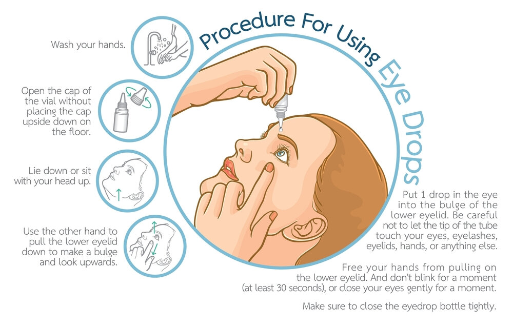 How To Use Lumigan Generic