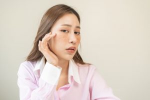 Retin A cream for dark spots