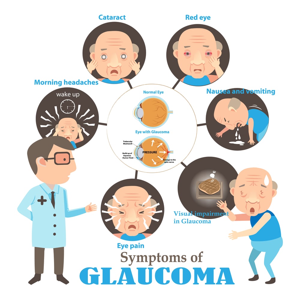 Glaucoma Symptoms Glaucoma Symptoms