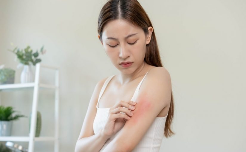 How to Stop Eczema Itching Immediately?