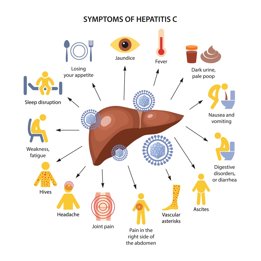 Hepatitis C Symptoms