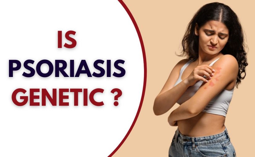 Is Psoriasis Genetic?