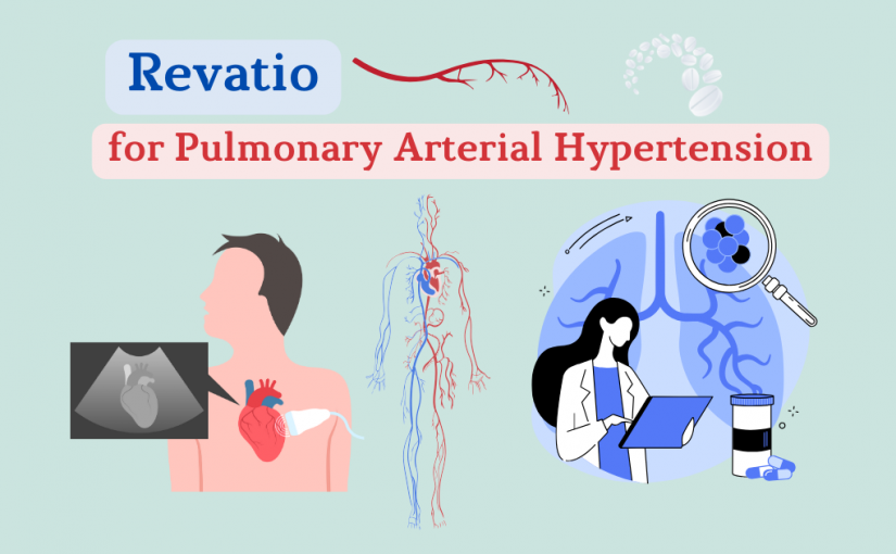 <strong>Revatio for Pulmonary Arterial Hypertension: How it Works</strong>
