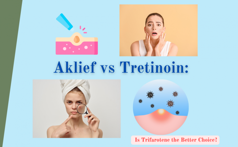 <strong>Aklief vs Tretinoin: Is Trifarotene the Better Choice?</strong>