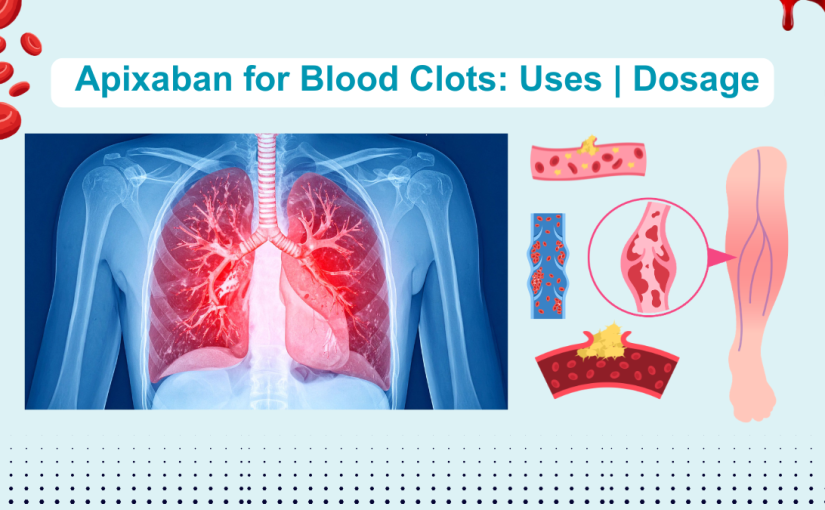 Apixaban for Blood Clots: Uses & Dosage